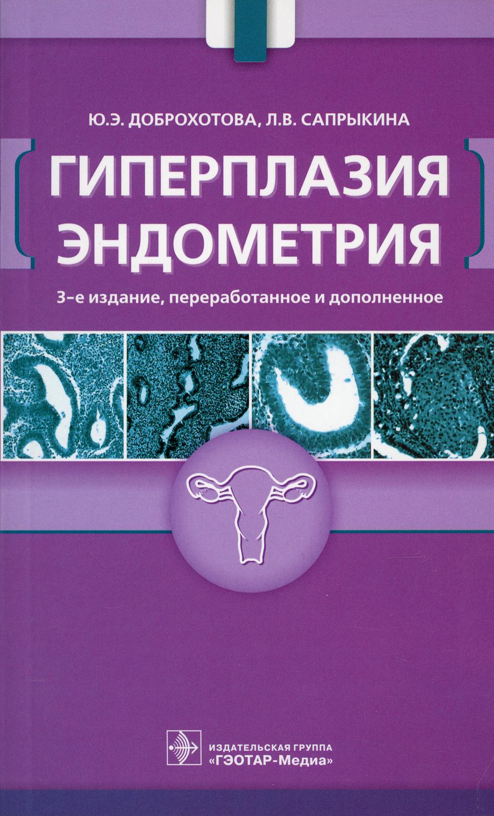 Гиперплазия эндометрия / Ю. Э. Доброхотова, Л. В. Сапрыкина. — 3-е изд., перераб. и доп. — Москва : ГЭОТАР-Медиа, 2021. — 112 с. : ил.