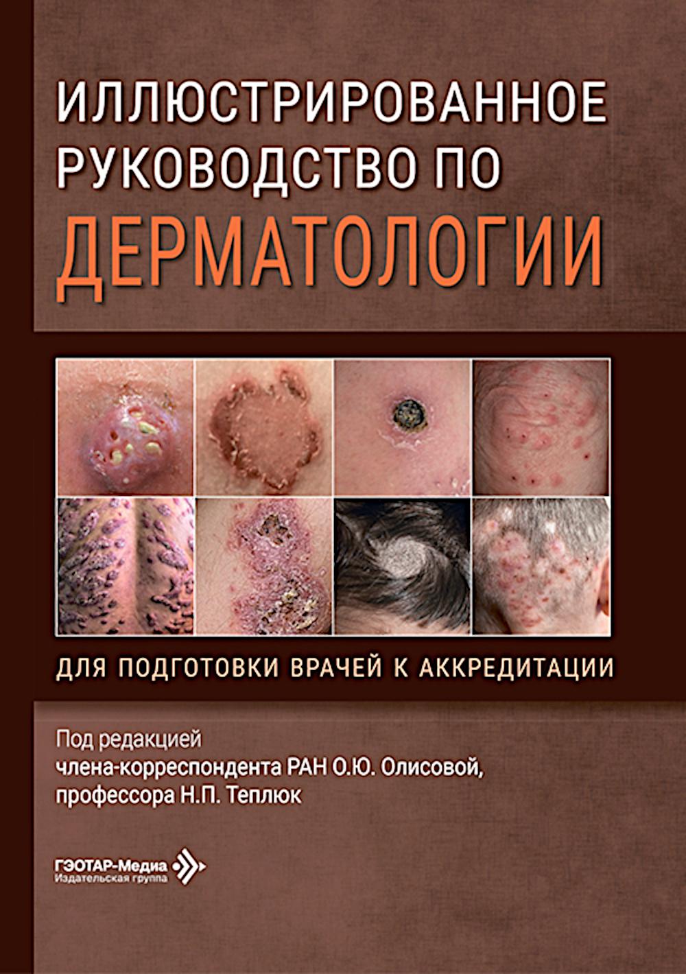 Иллюстрированное руководство по дерматологии. Для подготовки врачей к аккредитации / под ред. О. Ю. Олисовой, Н. П. Теплюк. — Москва : ГЭОТАР-Медиа, 2