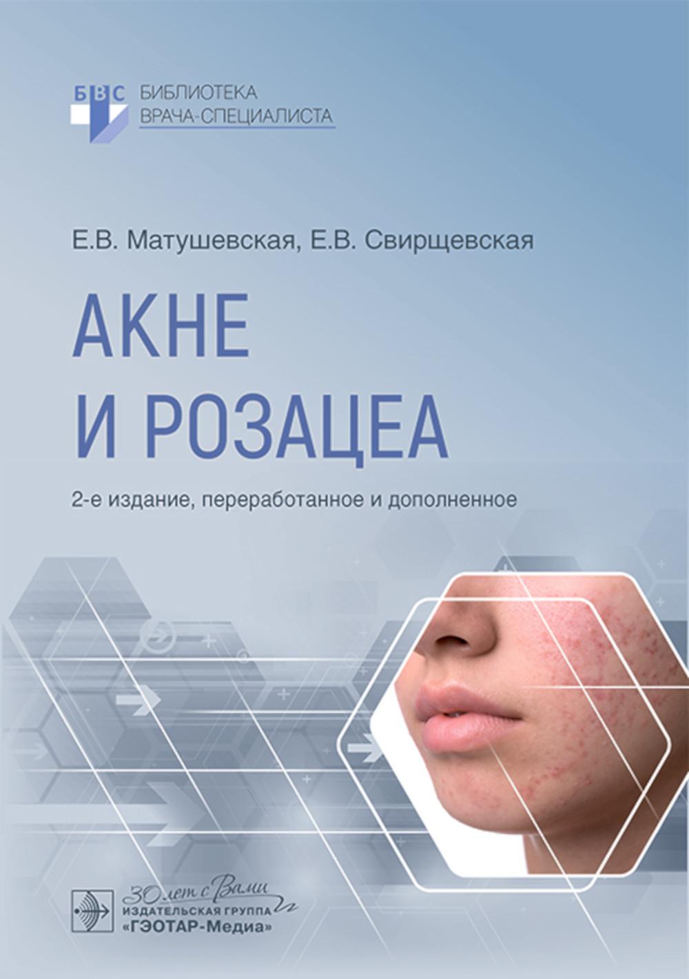 Акне и розацеа / Е. В. Матушевская, Е. В. Свирщевская. ― 2-е изд., перераб. и доп. ― Москва : ГЭОТАР-Медиа, 2024. ― 128 с. : ил. ― (Серия «Библиотека врача-специалиста»).