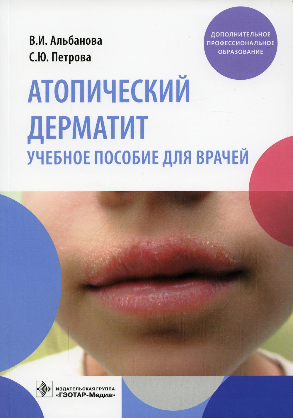 Атопический дерматит : учебное пособие для врачей / В. И. Альбанова, С. Ю. Петрова. — Москва : ГЭОТАР-Медиа, 2022. — 168 с. : ил. — (Серия «Дополнительное профессиональное образование»).
