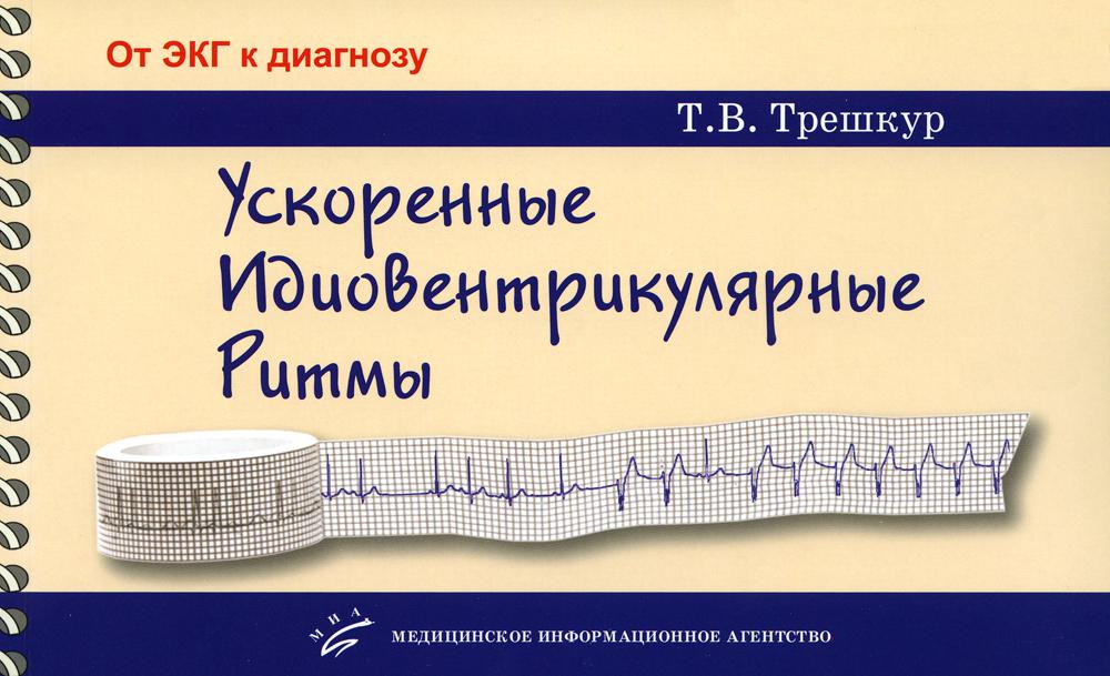 Ускоренные идиовентрикулярные ритмы: клинико-электрокардиографические особенности, систематизация по ЭКГ-характеристикам, дифференцирование с другими нарушениями ритма и аномалиями проводимости / Т.В. Трешкур ; под ред.