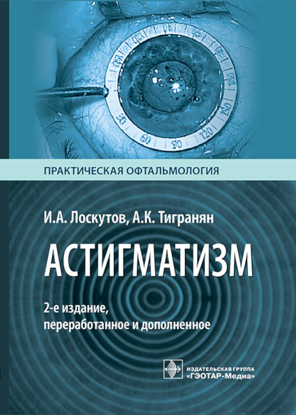 Астигматизм / И. А. Лоскутов, А. К. Тигранян. — 2-е изд., перераб. и доп. — Москва : ГЭОТАР-Медиа, 2026. — 192 с. : ил. — (Серия «Практическая офтальмология»).