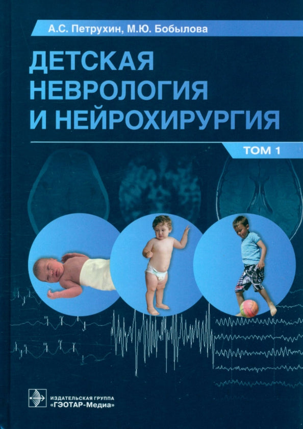 Детская неврология и нейрохирургия: учебник : в 2 т. / А. С. Петрухин, М. Ю. Бобылова и др. — Москва : ГЭОТАР-Медиа, 2023. — Т. 1. — 400 с. : ил.