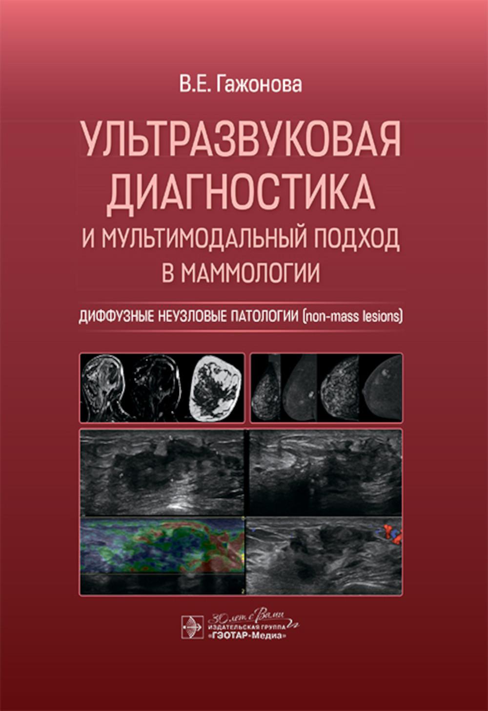 Ультразвуковая диагностика и мультимодальный подход в маммологии. Диффузные неузловые патологии (non-mass lesions) / В. Е. Гажонова. — Москва : ГЭОТАР-Медиа, 2025. — 480 с. : ил.