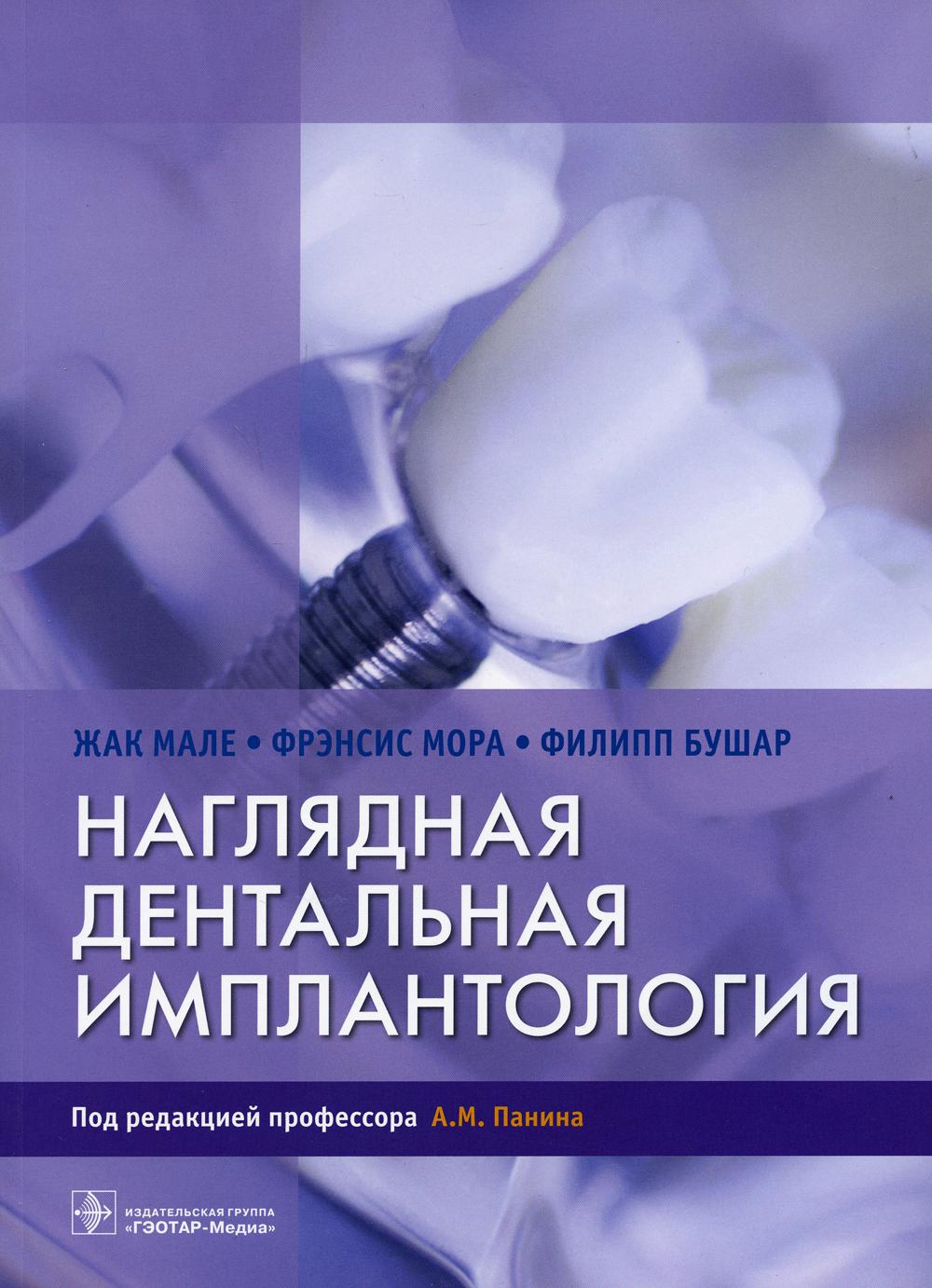 Наглядная дентальная имплантология / Жак Мале, Фрэнсис Мора, Филипп Бушар ; пер. с англ. под ред. А. М. Панина. — Москва : ГЭОТАР-Медиа, 2021. — 232 с. : ил.