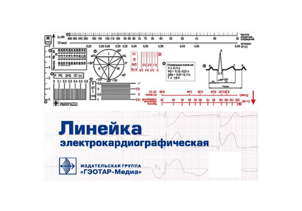 Линейка электрокардиографическая: ЭКГ-линейка для расшифровки электрокардиограммы, снятой со скоростью 50 или 25 мм/с, в футляре — Москва : ГЭОТАР-Медиа, 2025. — 1 линейка: 200 х 70 мм.