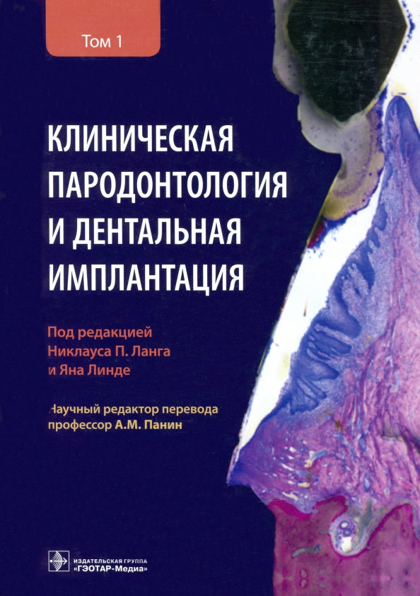 Клиническая пародонтология и дентальная имплантация : в 2-х т. : Т. 1 / под ред. Н. П. Ланга, Я. Линде; науч. ред. перевода А. М. Панин. — Москва : ГЭОТАР-Медиа, 2021. — 720 с. : ил.
