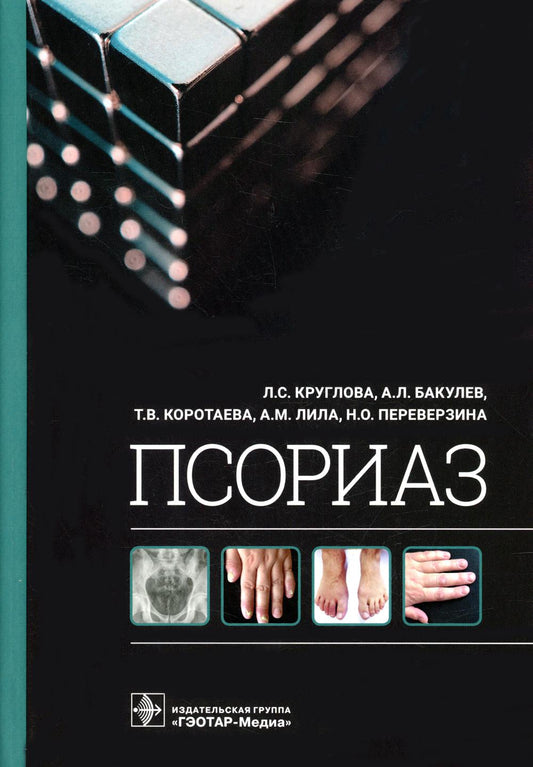Псориаз / Л. С. Круглова, А. Л. Бакулев, Т. В. Коротаева [и др.]. — Москва : ГЭОТАР-Медиа, 2022. — 320 с. : ил.
