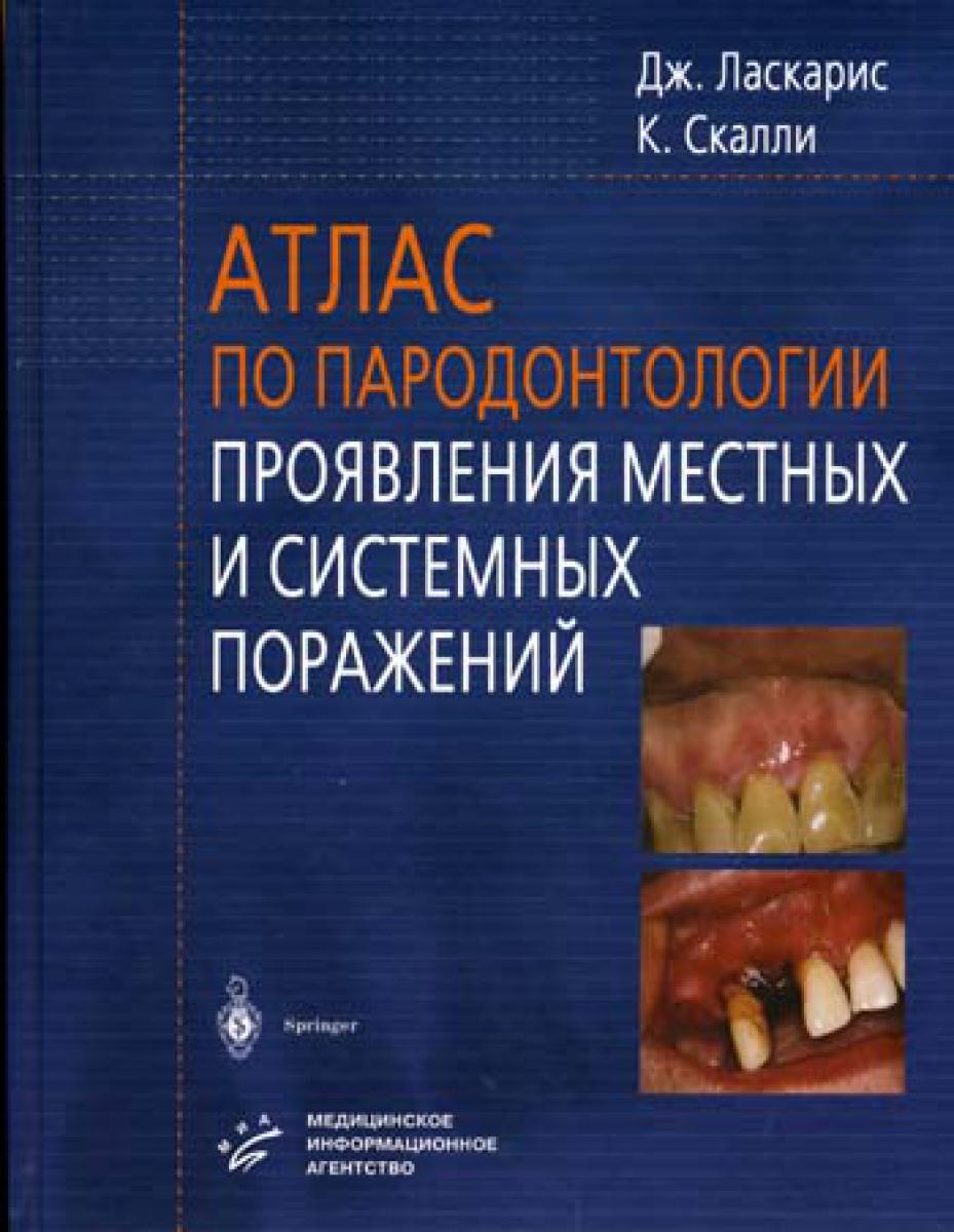 Атлас по пародонтологии. Проявления местных и системных поражений. Ласкарис Дж., Скалли К.