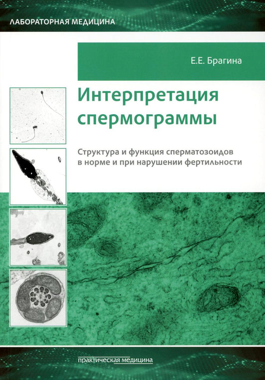 Интерпретация спермограммы. Структура и функция сперматозоидов в норме и при нарушении фертильности***