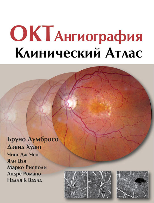 ОКТ-ангиография. Клинический атлас
