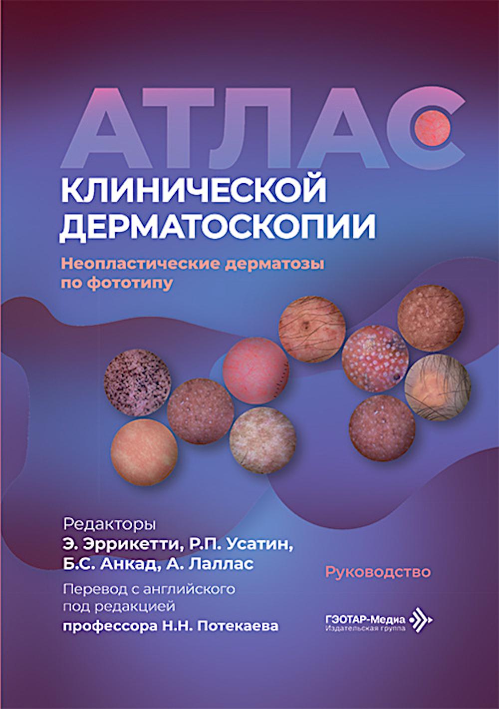 Атлас клинической дерматоскопии. Ненеопластические дерматозы по фототипу: руководство