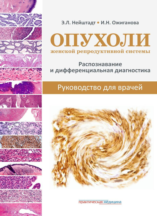Опухоли женской репродуктивной системы. Распознавание и дифференциальная диагностика. Руководство для врачей***