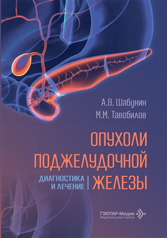 Опухоли поджелудочной железы: диагностика и лечение