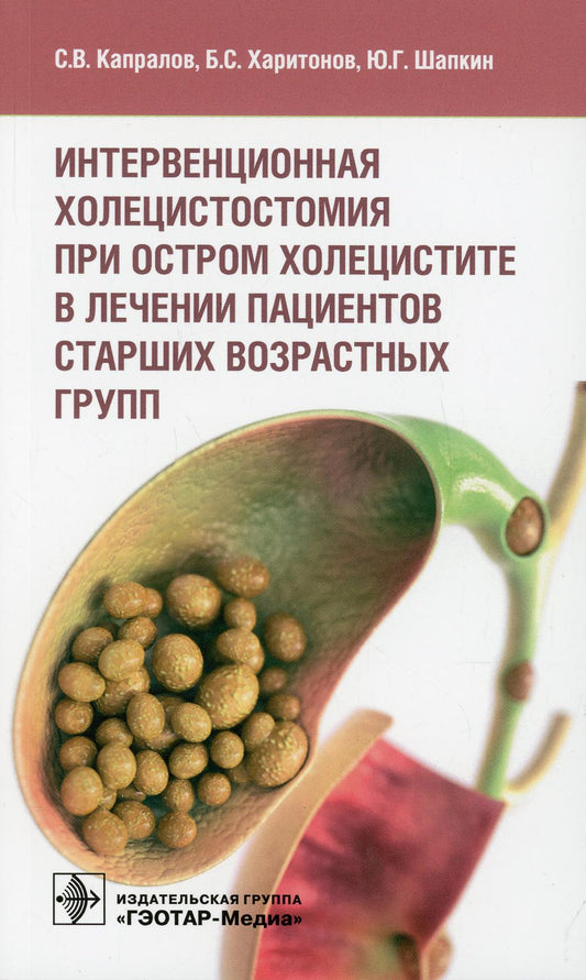 Интервенционная холецистостомия при остром холецистите в лечении пациентов старших возрастных групп / С. В. Капралов, Б. С. Харитонов, Ю. Г. Шапкин. — Москва : ГЭОТАР-Медиа, 2022. — 128 с. : ил.