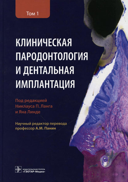 Клиническая пародонтология и дентальная имплантация : в 2-х т. : Т. 1 / под ред. Н. П. Ланга, Я. Линде; науч. ред. перевода А. М. Панин. — Москва : ГЭОТАР-Медиа, 2021. — 720 с. : ил.