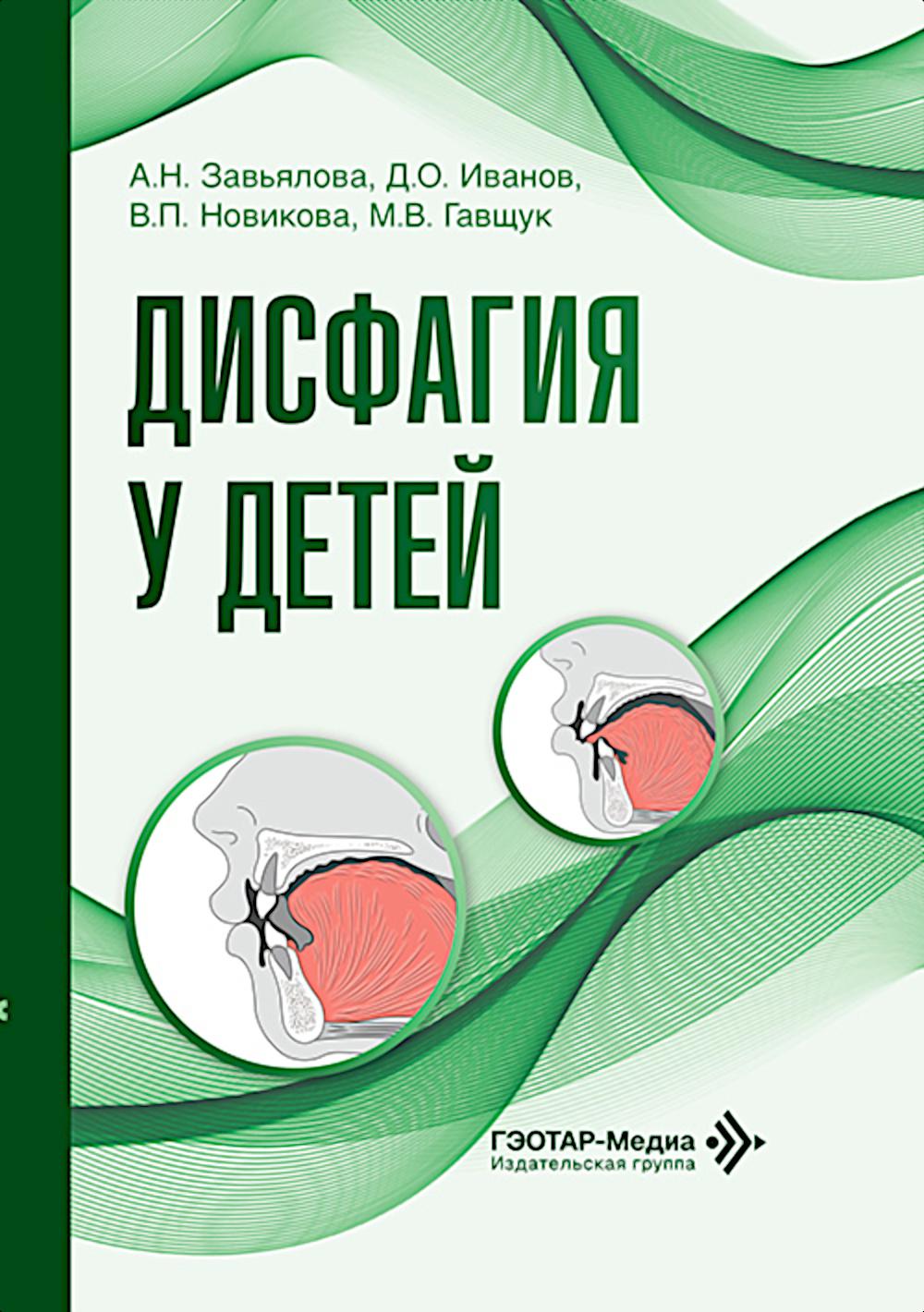 Дисфагия у детей