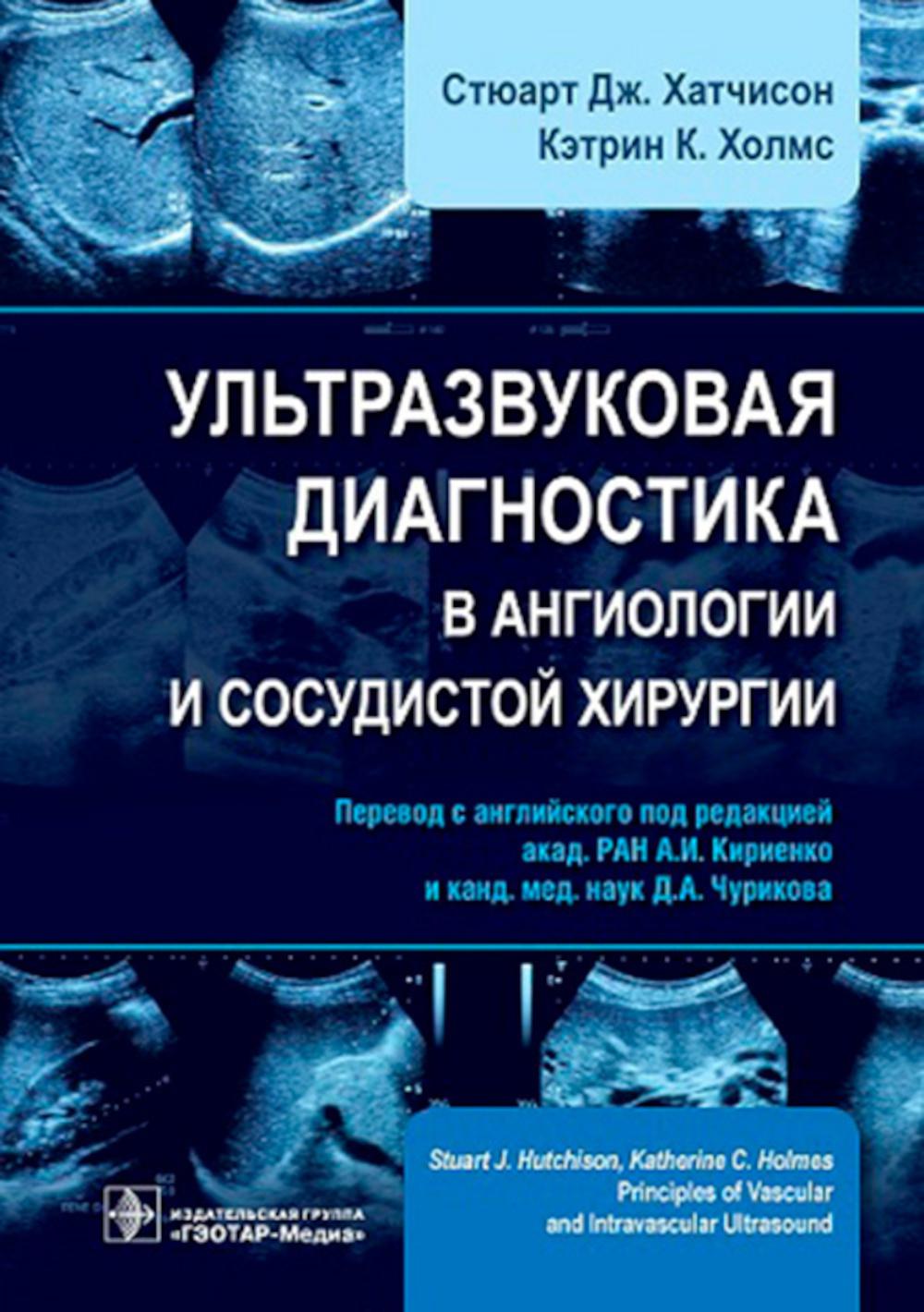 Ультразвуковая диагностика в ангиологии и сосудистой хирургии / Стюарт Дж. Хатчисон, Кэтрин К. Холмс ; пер. с англ. под ред. А. И. Кириенко, Д. А. Чурикова. — Москва : ГЭОТАР-Медиа, 2023. — 400 с. : ил.
