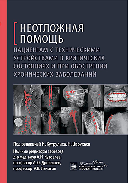 Неотложная помощь пациентам с техническими устройствами в критических состояниях и при обострении хронических заболеваний / под ред. И. Кутрулиса, Н. Царухаса; пер. с англ. под ред. А. Н. Кузовлева, А. Ю. Дробышева, А. В. Лычагина. — Москва : ГЭОТАР-Медиа