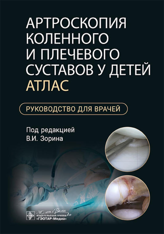 Артроскопия коленного и плечевого суставов у детей. Атлас : руководство для врачей / под ред. В. И. Зорина. — Москва : ГЭОТАР-Медиа, 2024. — 136 с. : ил.