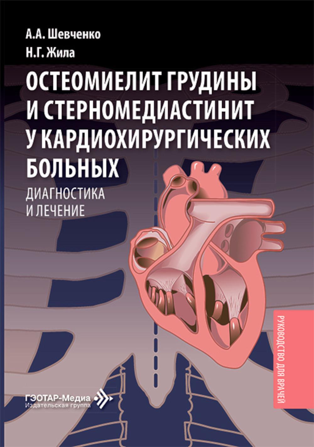 Остеомиелит грудины и стерномедиастинит у кардиохирургических больных. Диагностика и лечение: руководство для врачей