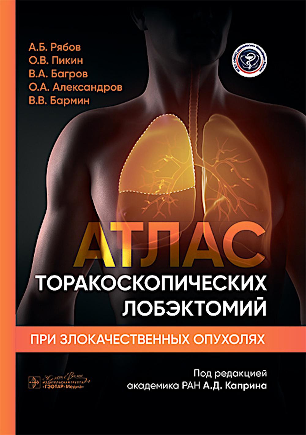 Атлас торакоскопических лобэктомий при злокачественных опухолях / А. Б. Рябов, О. В. Пикин, В. А. Багров [и др.] ; под ред. А. Д. Каприна. — Москва : ГЭОТАР-Медиа, 2025. — 76 с. : ил.
