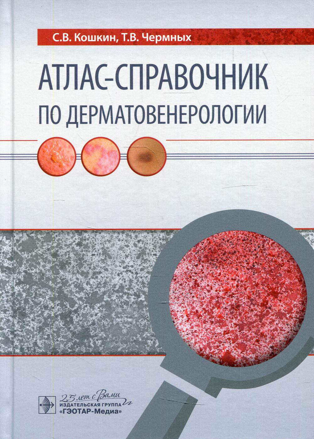 Атлас-справочник по дерматовенерологии / С. В. Кошкин, Т. В. Чермных. — Москва : ГЭОТАР-Медиа, 2020. — 144 с. : ил. — DOI: 10.33029/9704-5765-8-ASD-2020-1-144.