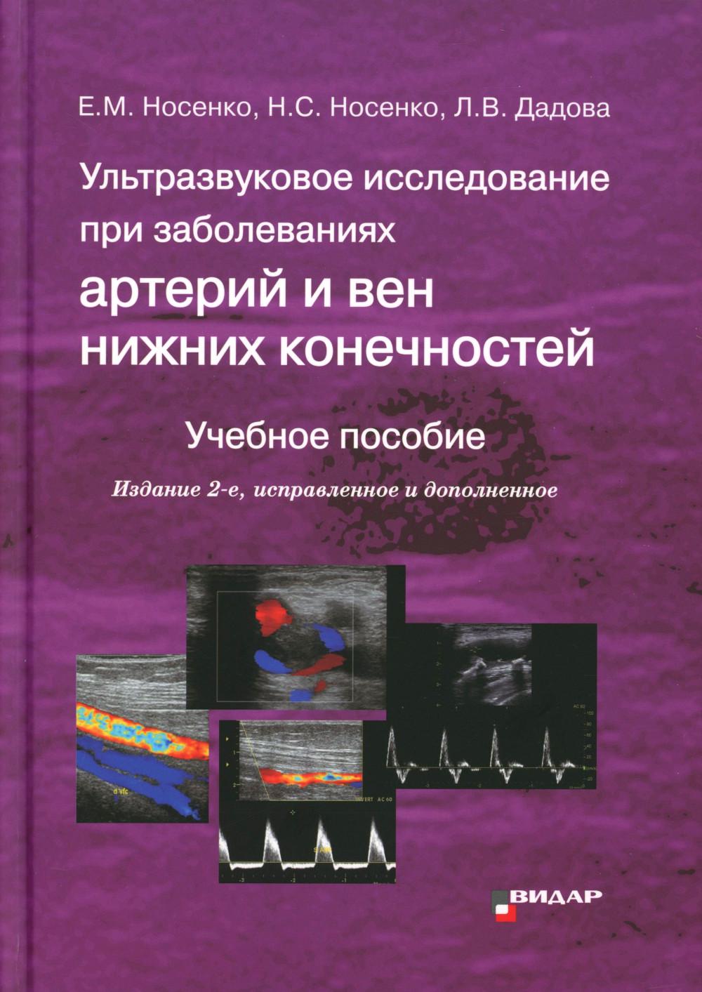 Ультразвуковое исследование при заболеваниях артерий и вен нижних конечностей: Учебное пособие. 2-е изд., испр.и доп
