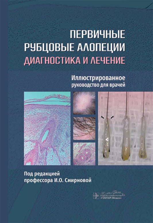 Первичные рубцовые алопеции: диагностика и лечение : иллюстрированное руководство для врачей / под ред. И. О. Смирновой. — Москва : ГЭОТАР-Медиа, 2025. — 296 с. : ил.