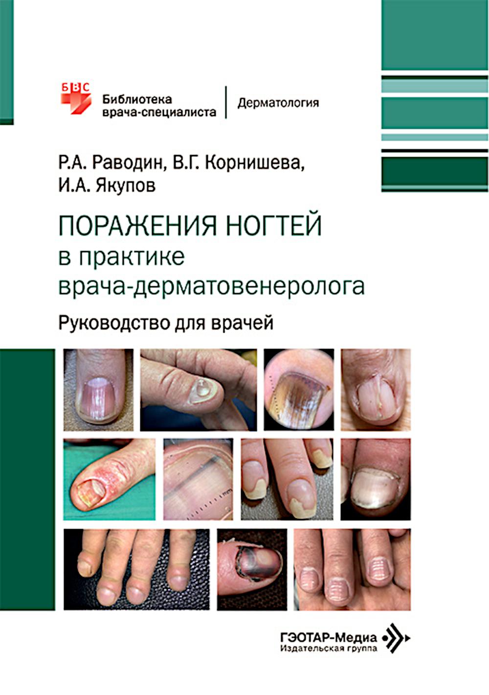 Поражения ногтей в практике врача-дерматовенеролога: руководство для врачей