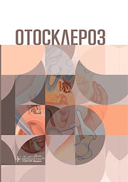 Отосклероз / А. И. Крюков, Ю. К. Янов, Е. В. Гаров [и др.]. — Москва : ГЭОТАР-Медиа, 2025. ― 200 с. : ил.
