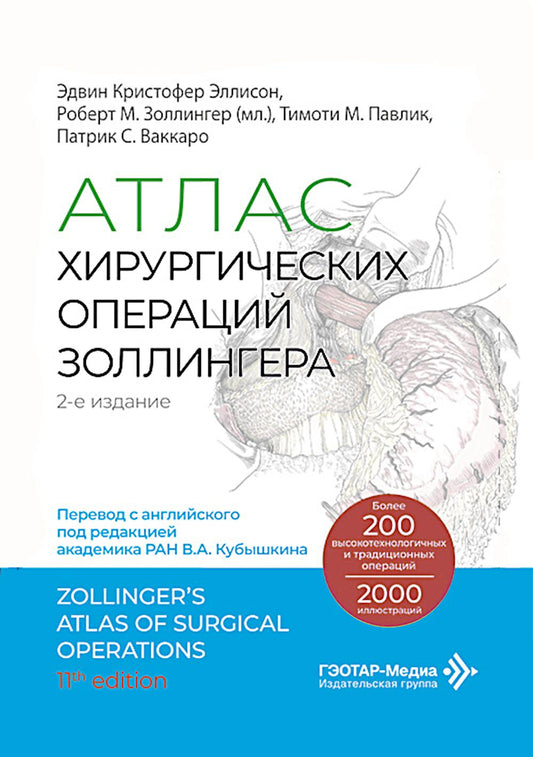 Атлас хирургических операций Золлингера. 2-е изд