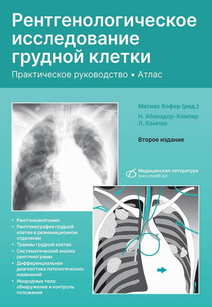 Рентгенологическое исследование грудной клетки. Практическое руководство. Атлас. 2-е изд., перераб.и доп