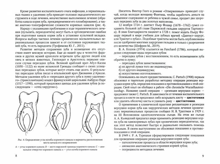 Резекция верхушек корней зубов - лечение периапикальных процессов: Учебное пособие