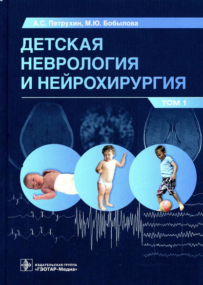 Детская неврология и нейрохирургия: учебник : в 2 т. / А. С. Петрухин, М. Ю. Бобылова и др. — Москва : ГЭОТАР-Медиа, 2023. — Т. 1. — 400 с. : ил.