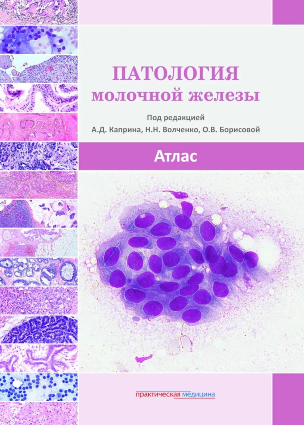 Патология молочной железы. Атлас