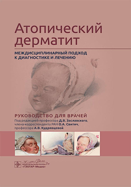 Атопический дерматит. Междисциплинарный подход к диагностике и лечению : руководство для врачей / под ред. Д. В. Заславского, О. А. Свитич, А. В. Кудрявцевой. — Москва : ГЭОТАР-Медиа, 2025. — 272 с. : ил.