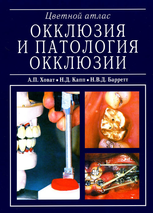 А.П. Ховат, Н.Д.Капп "Окклюзия и патология окклюзии. Цветной атлас. М., 2005