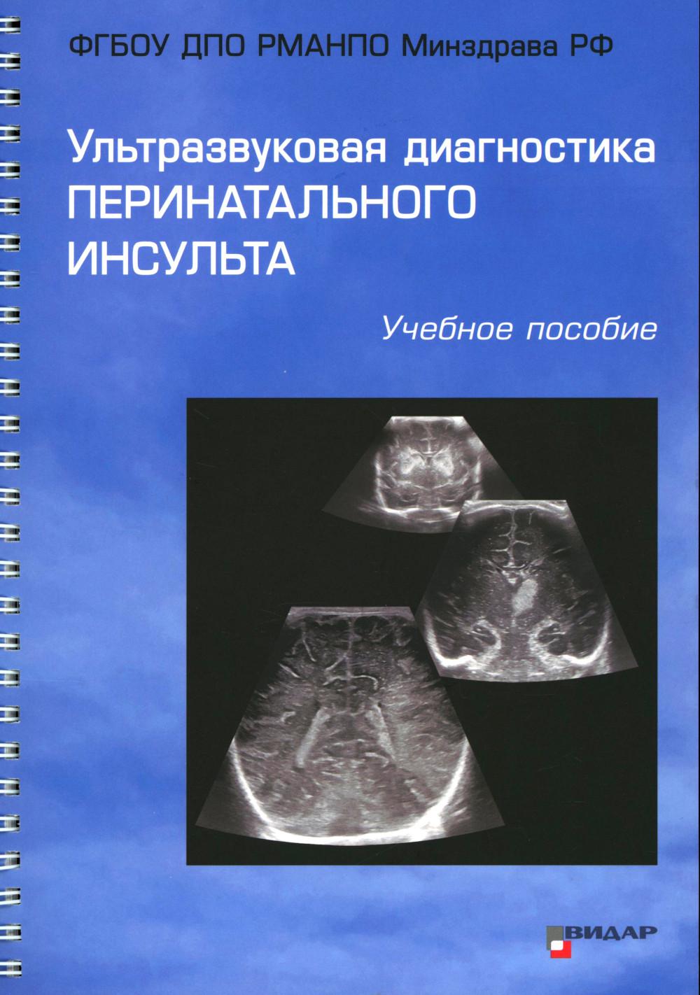 Ультразвуковая диагностика перинатального инсульта: Учебное пособие