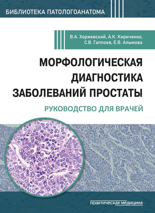Морфологическая диагностика заболеваний простаты. Руководство для врачей