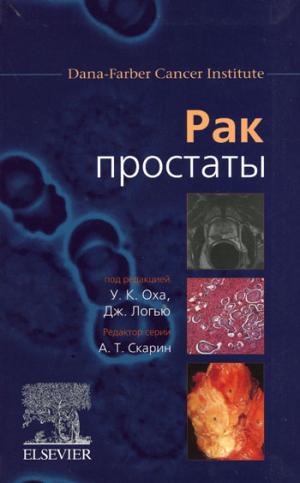 Рак простаты